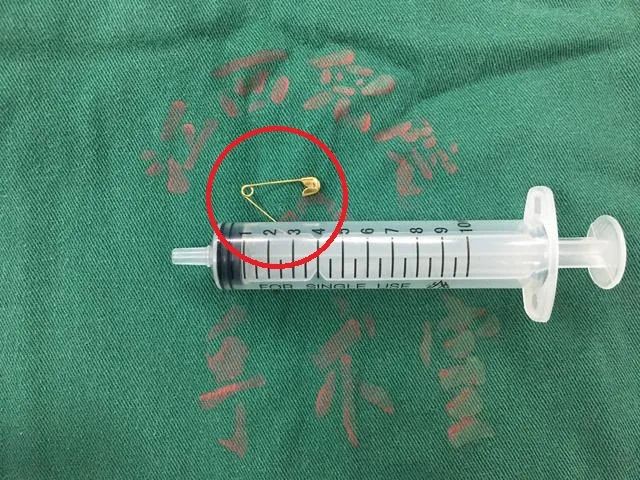 一岁男童吞别针,小孩误吞异物到食道怎么办