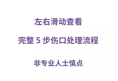 被流浪猫咬到没什么大事吧,不小心被猫咬了一口要打针么