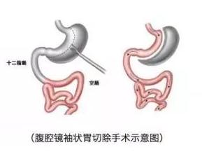 什么公式可以计算自己算不算胖,计算你是不是真胖的公式