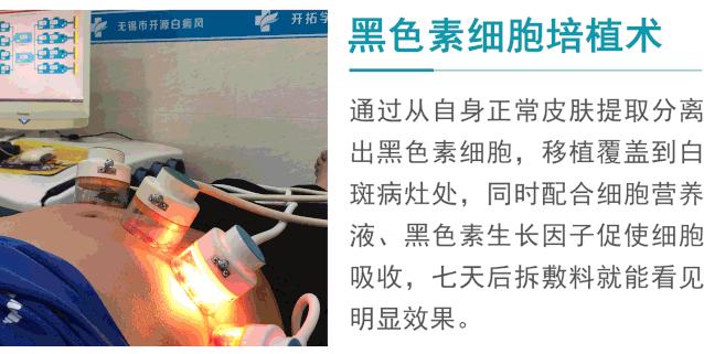 全国征集10名白癜风病友免费治疗,白癜风公益招募500名患者