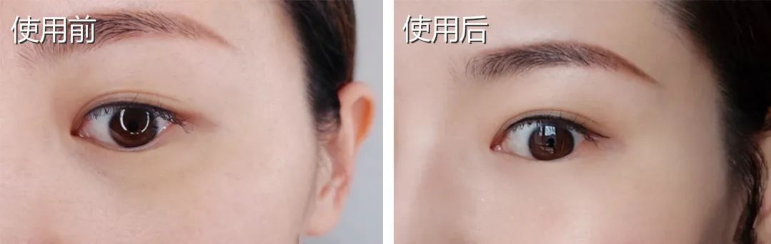 国货眼霜马应龙八宝,马应龙去黑眼霜官方旗舰店