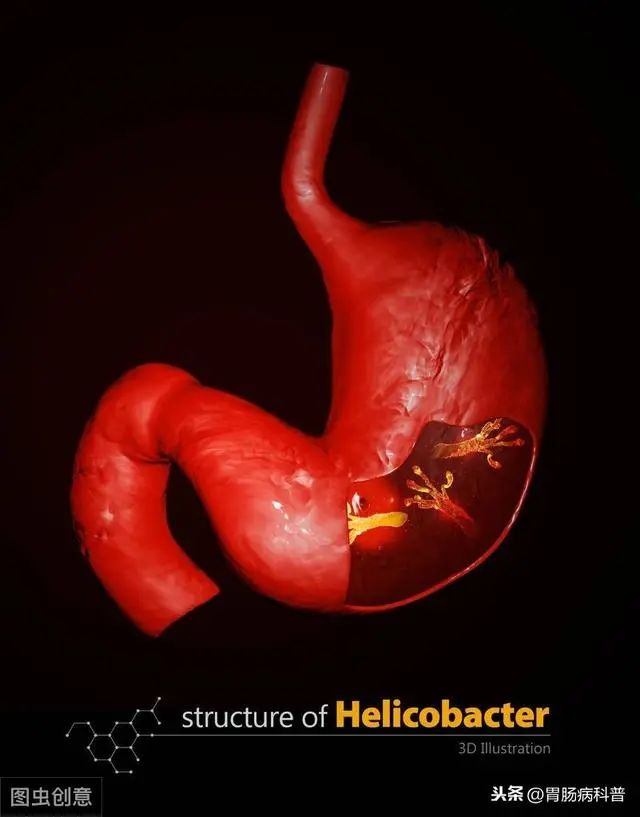 根除幽门螺杆菌常用的有效方案为,幽门螺杆菌用药期间可以喝牛奶吗