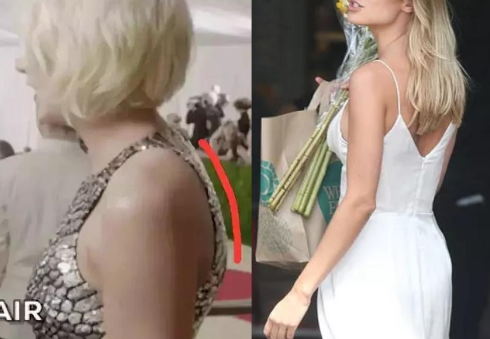 含胸驼背最损气质手把手教你纠正,含胸驼背如何改善提升气质