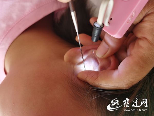 采耳师在“3厘米”间窥见不凡