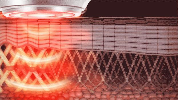 射频美容仪到底怎样,射频美容仪合格吗