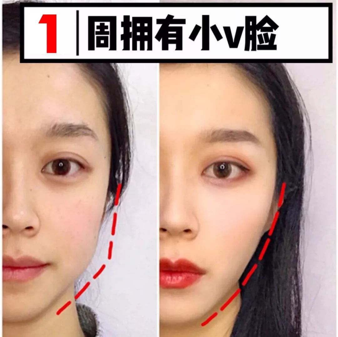 瘦脸小v脸的方法,每天张嘴闭嘴100下能瘦脸吗