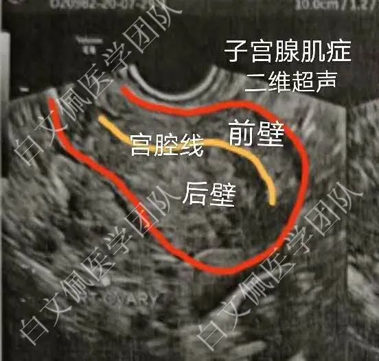 全彩人体解剖学图谱第二版,盆腔解剖学彩图教学视频