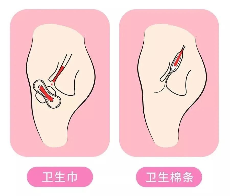 比姨妈巾好用的东西,经期有什么比姨妈巾更好用的