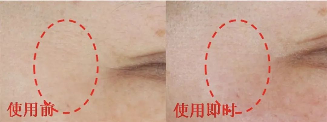 用空瓶回购眼霜,值得空瓶回购的眼霜