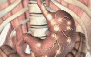 感觉嘴里有股肠胃的臭味,肠胃有一股腐臭味怎么回事