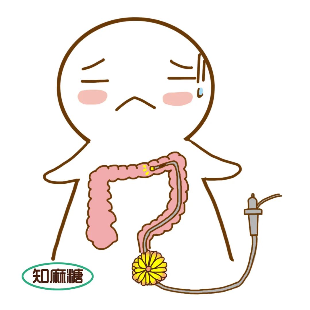 胃肠镜能睡着做，就别醒着了