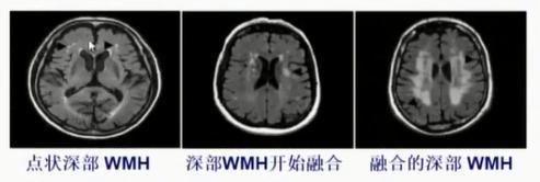 徐运神经内科,徐运医生怎么样