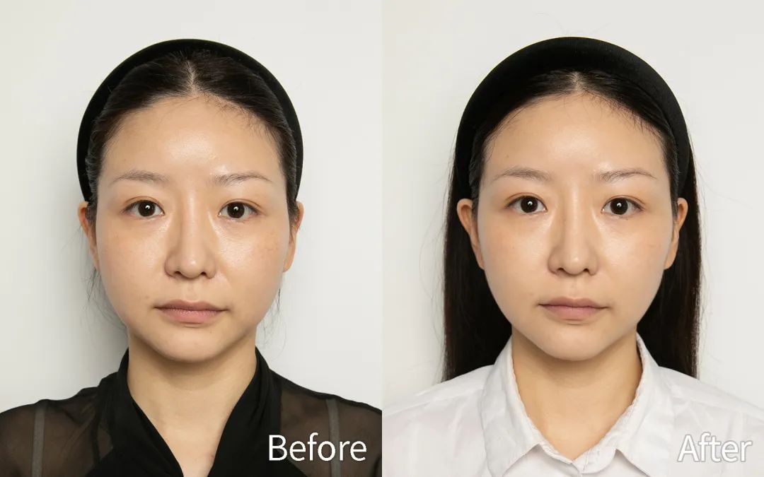 抗老真相,抗老的真相