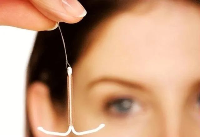 那些遗忘在体内的节育环该取出了