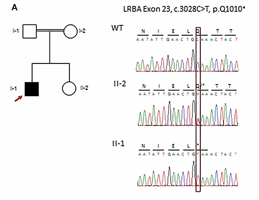 lr858基因突变,lrba基因