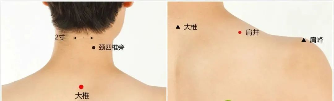 缓解颈椎病疼痛的方法,被颈椎腰椎折磨的日常