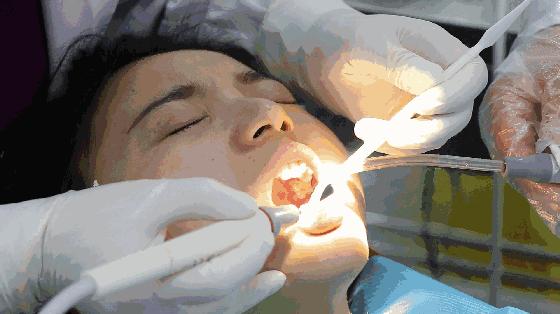 拯救牙黄牙黑口臭的看过来,黄牙黑牙有救了