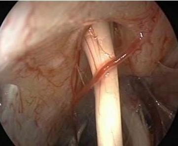 搬家后站立都成了奢望,59岁阿姨:一天头晕几十回,真是因为风水不好吗?