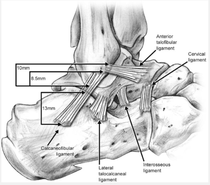 反复崴脚绝不是巧合,反复崴脚是渐冻症吗