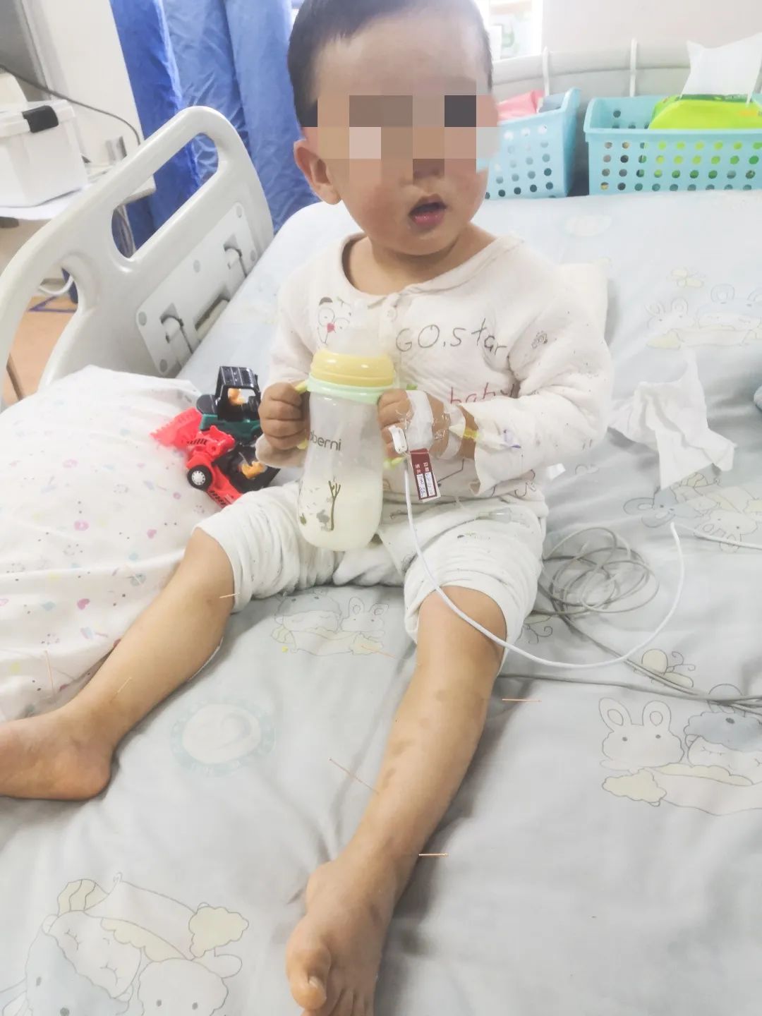 孩子12岁吉兰巴雷综合征,吉兰巴雷综合征患者瘫痪