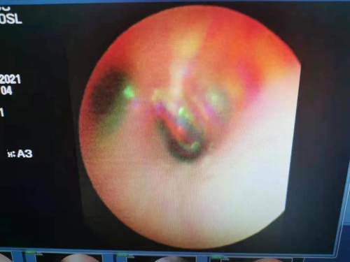 3岁孩子突然晚上睡觉打呼噜,3岁男宝宝睡觉打呼噜什么原因