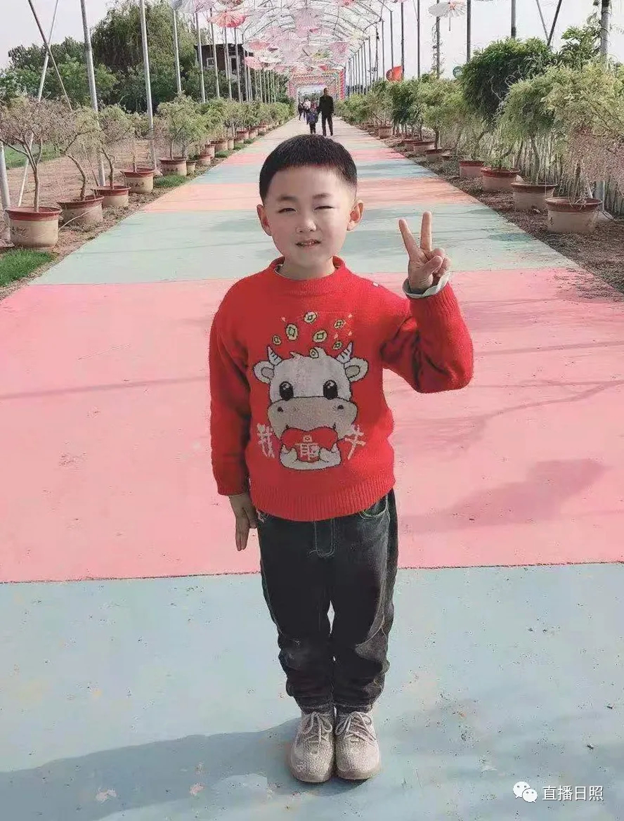 5岁男孩腿上老是有青一块紫一块,5岁男孩小腿出现圆点淤青