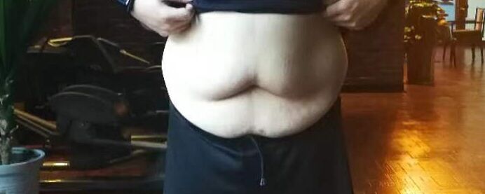 节食减肥下来皮肤松弛怎么办,节食减肥后皮肤松弛能吃回来吗