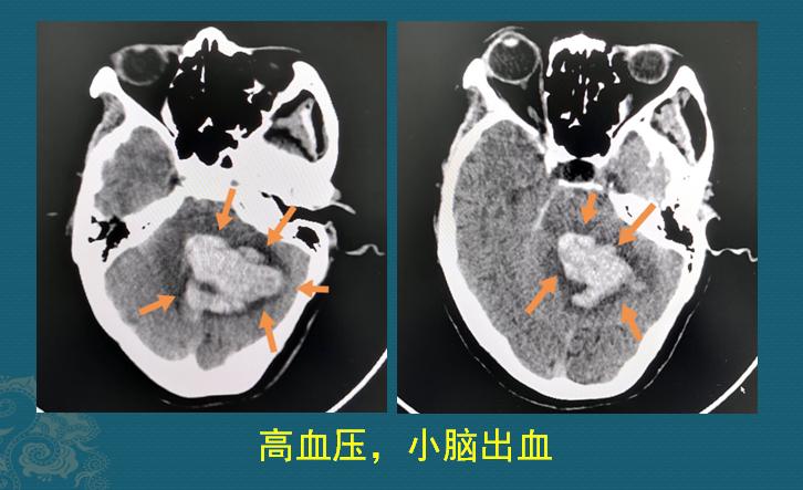 母亲节适合给母亲送的礼物推荐,母亲节送给母亲十佳礼物实用