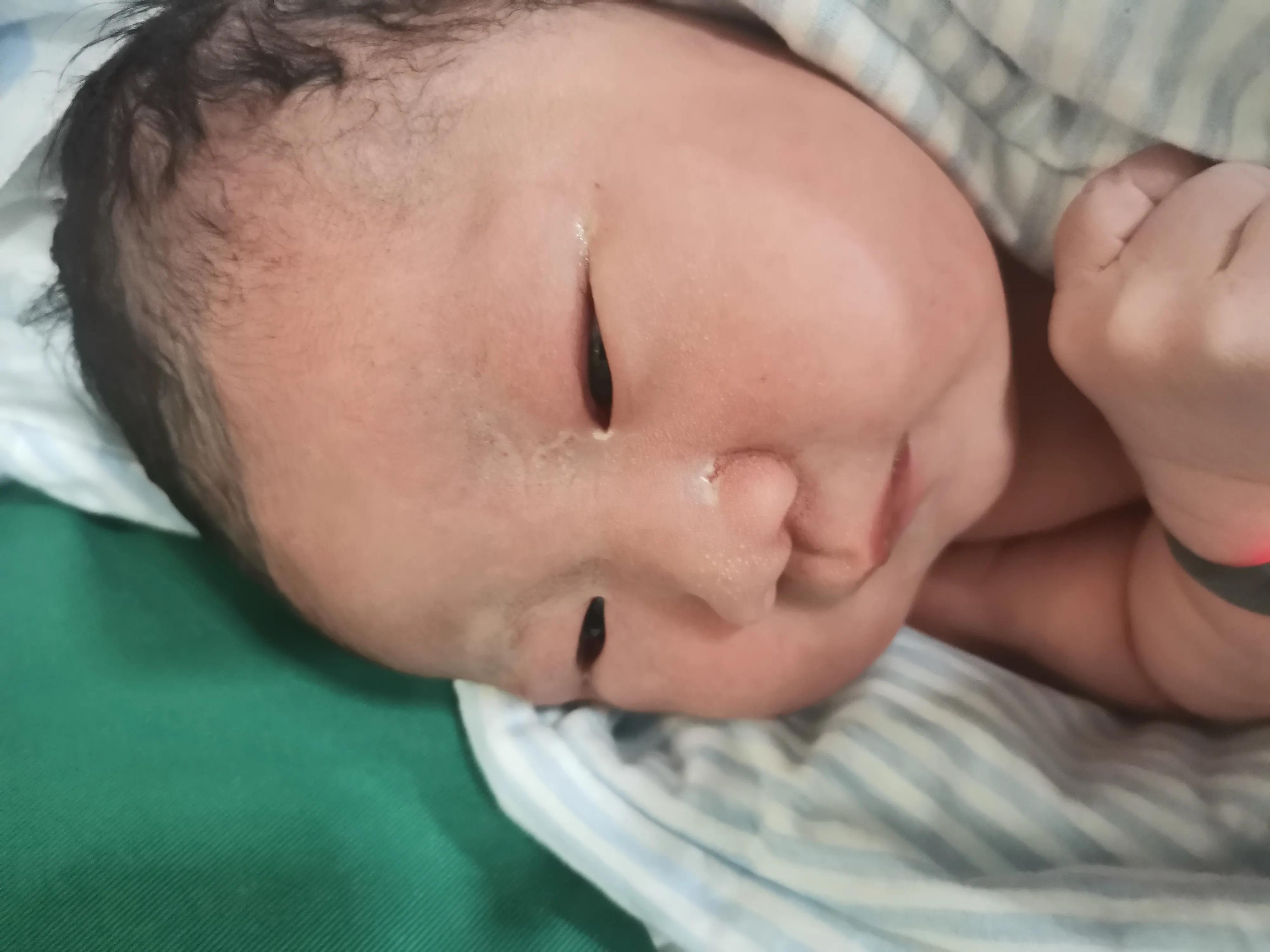 产后要不要用束腹带,产后要不要用束腹带呢图片