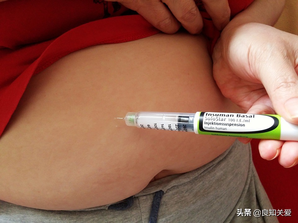 打胰岛素后痒是怎么回事,糖尿病打胰岛素瘙痒怎么处理