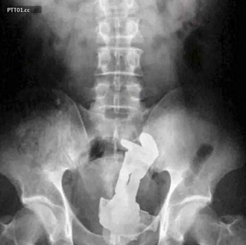 不作死就不会死看看你中了几条,不作死就不会死让人看的头皮发麻