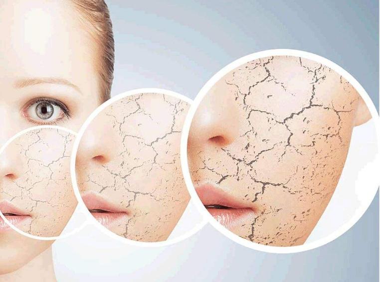 背部爆痘用什么药,背部长痘原因以及怎么调理