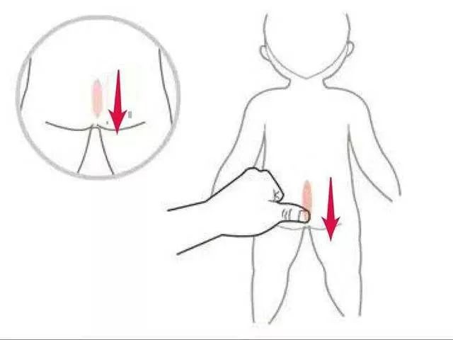 3岁孩子便秘1年，却不知搞错原因！难怪治不好
