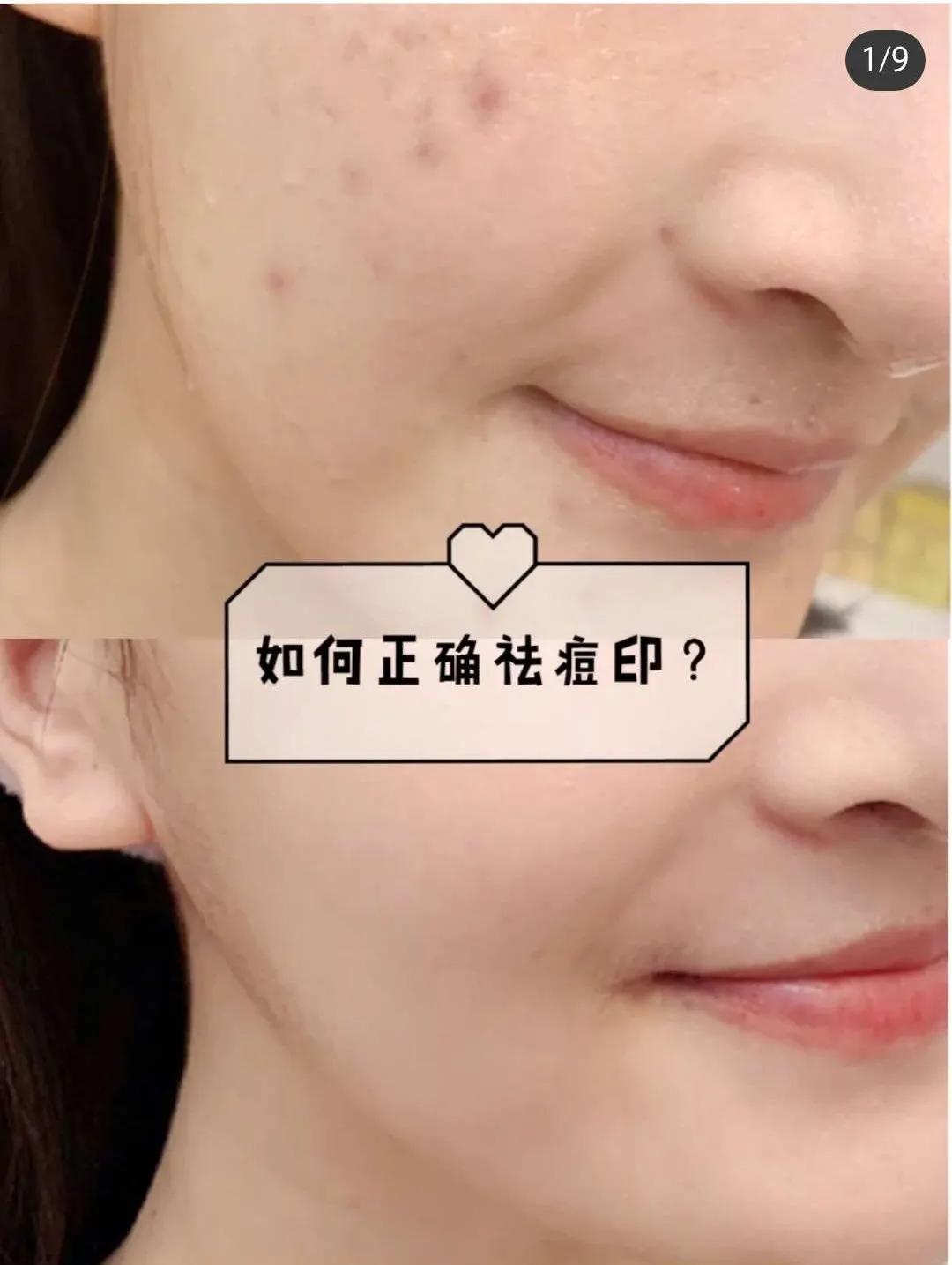 「好评反馈来啦」疯狂打call，实力表白｜为什么*干粉冻**这么受欢迎