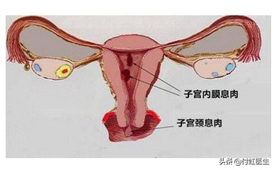 怎么让月经血块快速排出,月经期间有血块排出正常吗
