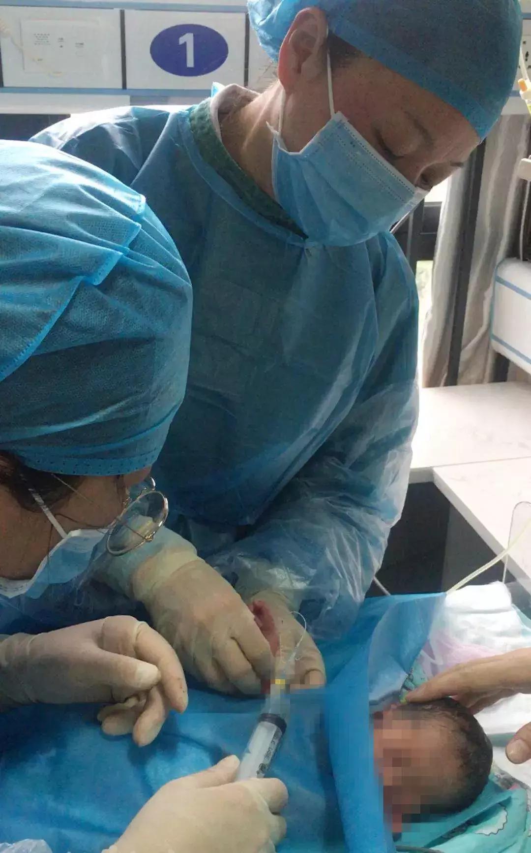 景市一院成功开展新生儿经外周静脉置入中心静脉导管（PICC）术