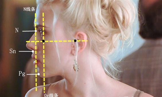 女生面部凹陷自救,女生面部凹陷