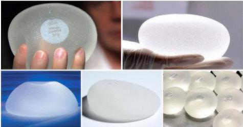 假体隆胸能保持多少年乳房不下垂,隆胸还是毁胸揭秘假体隆胸的危害