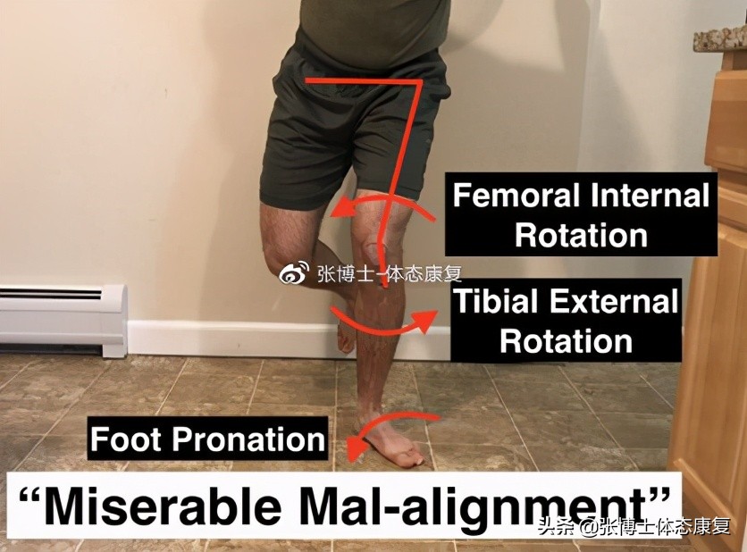 运动康复膝关节疼痛解决,下髌骨关节疼痛综合征