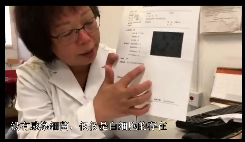 宫颈癌筛查tct轻度炎症严重吗,宫颈癌tct检查有炎症hpv16阳性