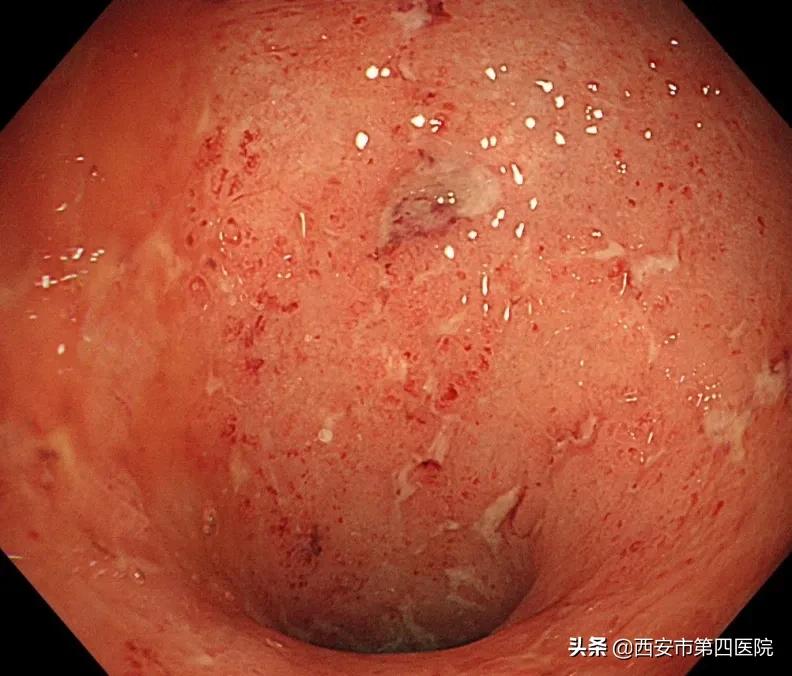 健康中国2023重大行动,健康中国行动是真是假