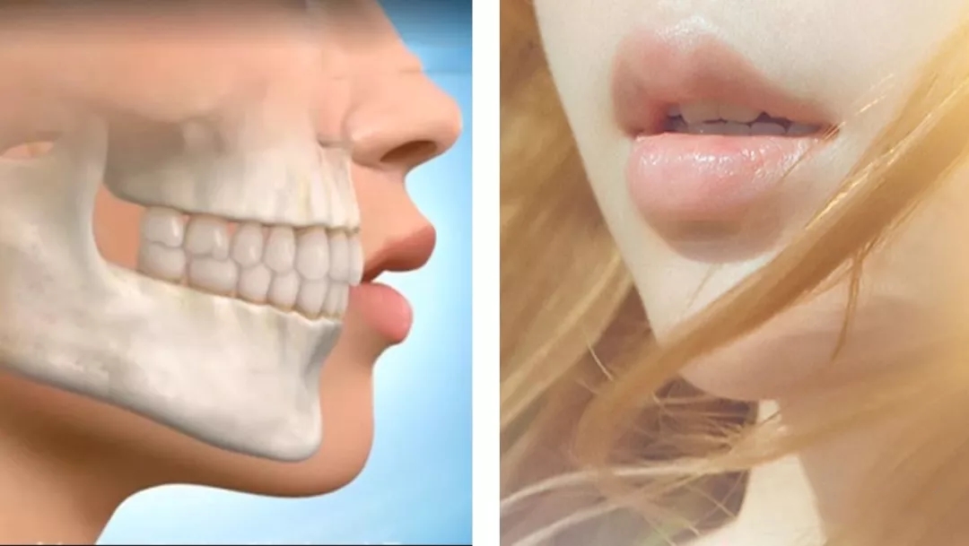 蔡徐坤整牙前后对比图片,蔡徐坤整牙前图片