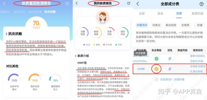 刷酸后黑头容易挤出来,刷酸后黑头多毛孔特别大了
