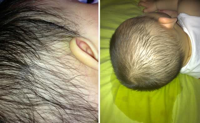 儿童睡觉头出汗是什么原因引起的,小孩睡觉头爱出汗是什么原因