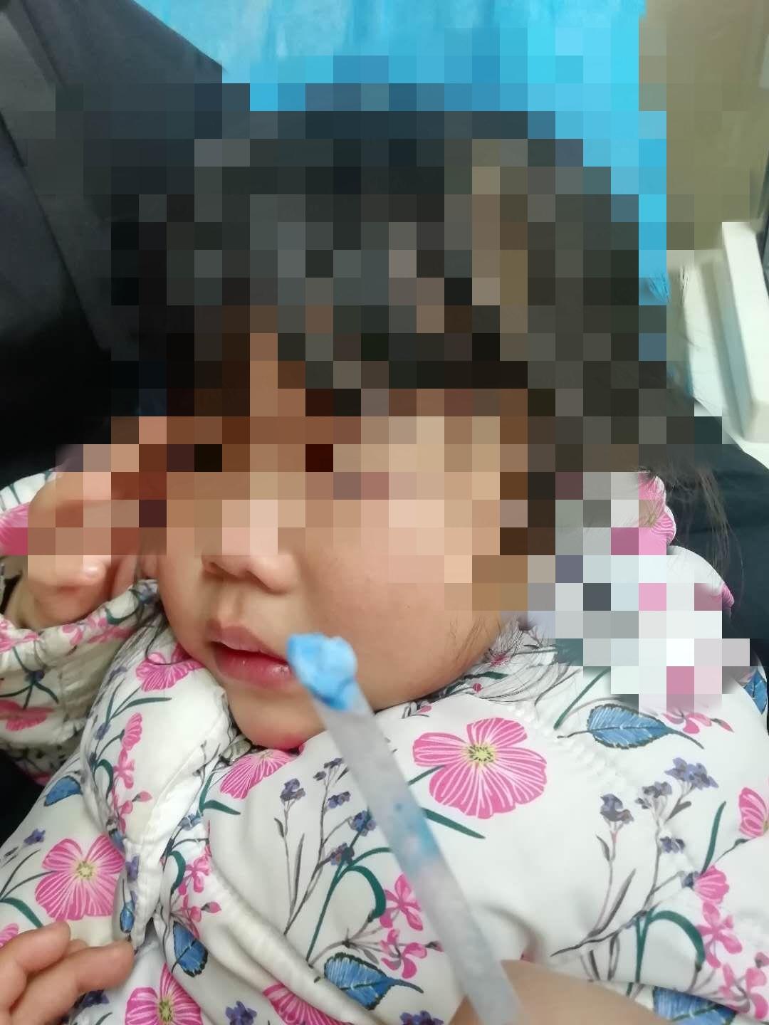 家长注意！徐州多名孩子鼻孔里出现了*珠钢**、西瓜、橡皮泥……