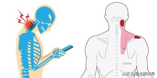 治颈椎的瑜伽动作有哪些,治颈椎最好的瑜伽动作