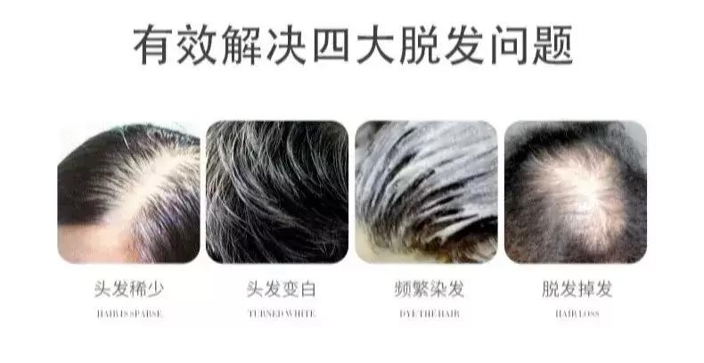 中年妈妈减龄发型短发,减龄中年发型短发