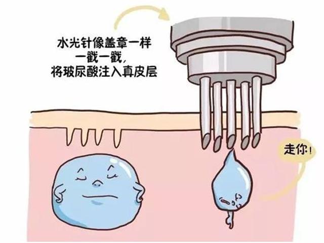 皮肤粗糙毛孔粗大自愈,毛孔粗大毛孔里都是白的