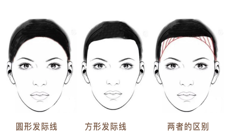 发际线到底怎样才好看,为什么有人的发际线好看