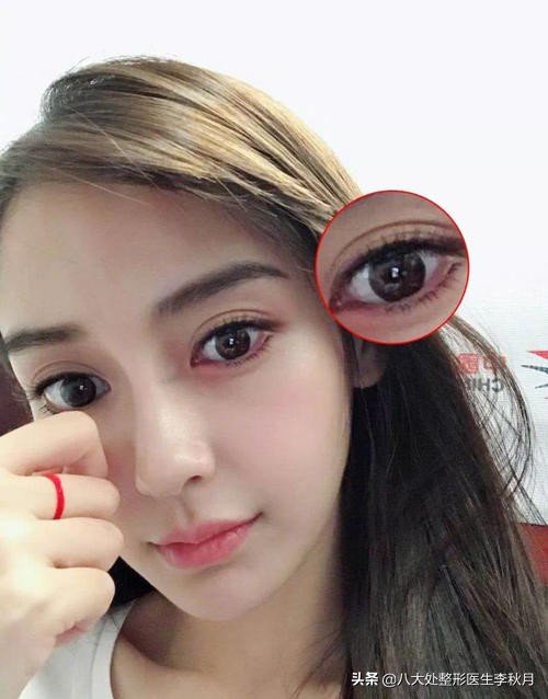 哪些男女明星双眼皮是割的,娱乐圈双眼皮男明星